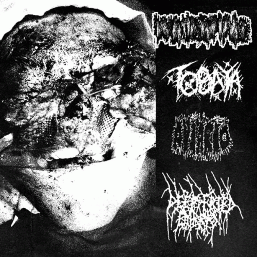 Regurgitasi : 4​-​Ways of Excruciating Pain